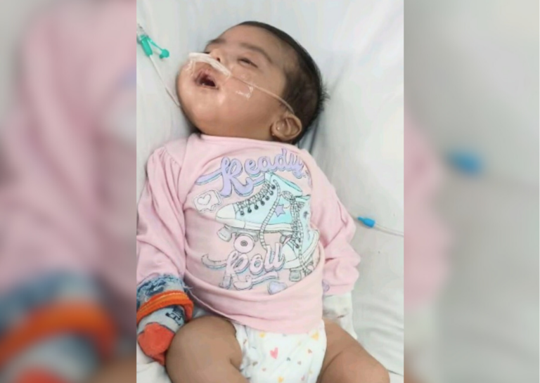 Cadena de oración por Olivia: una bebé sanlorencina de dos meses lucha por su vida en terapia intensiva