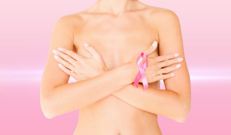 San Lorenzo: Brindan charla abierta sobre cáncer de mama con destacados especialistas