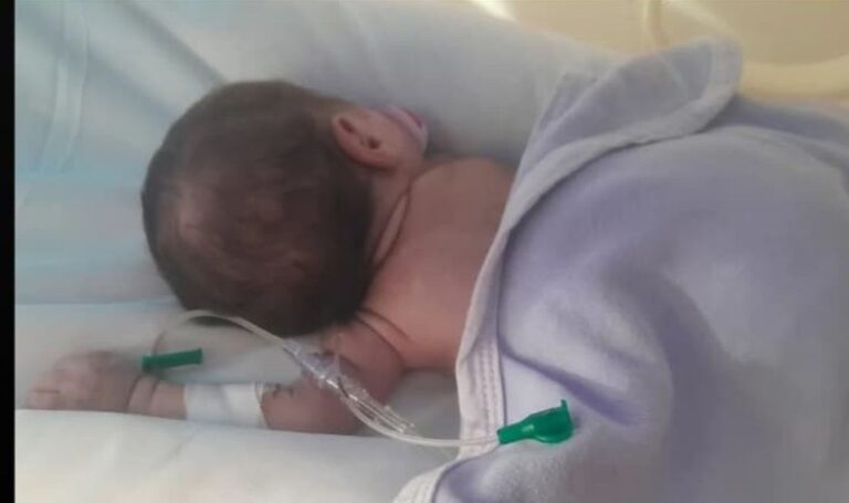 Una madre soltera pide ayuda para la lucha de su hija prematura contra la hidrocefalia