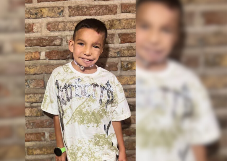 Bauti vuelve al quirófano y necesita ayuda: una cirugía clave para respirar, alimentarse y recuperar su voz