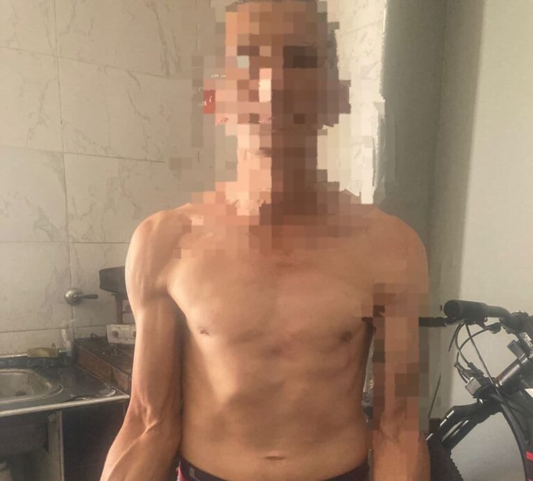 Ingresó a una vivienda ajena en San Lorenzo y fue detenido por la policía